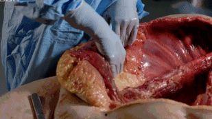 吃瓜解剖恶心事件,揭秘网络暴力背后的黑暗面